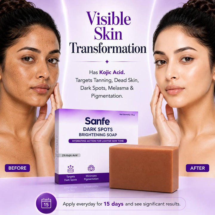 Sanfe Dark Spots Brightening Soap 75g (Pack of 5)