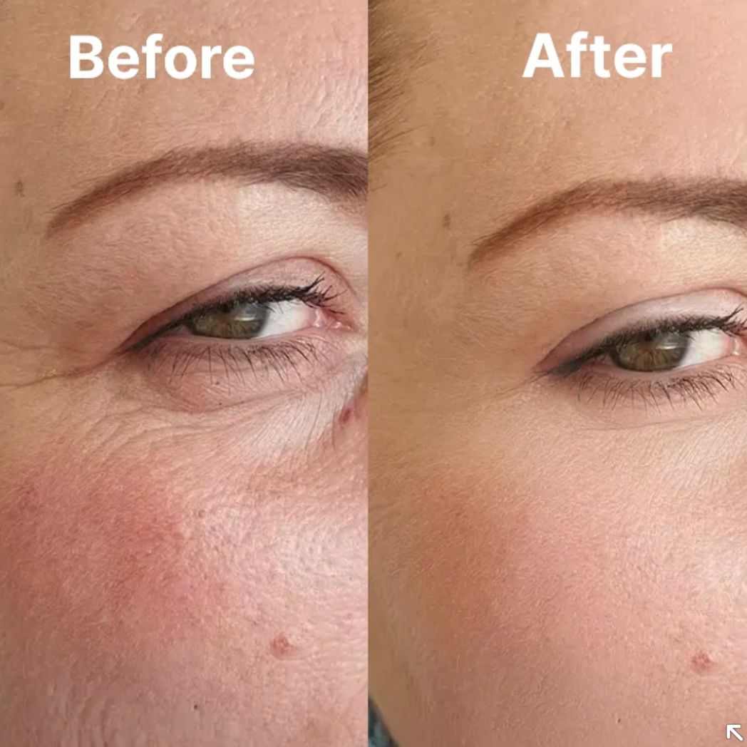 Sanfe Luminex Retinal Shot Cream