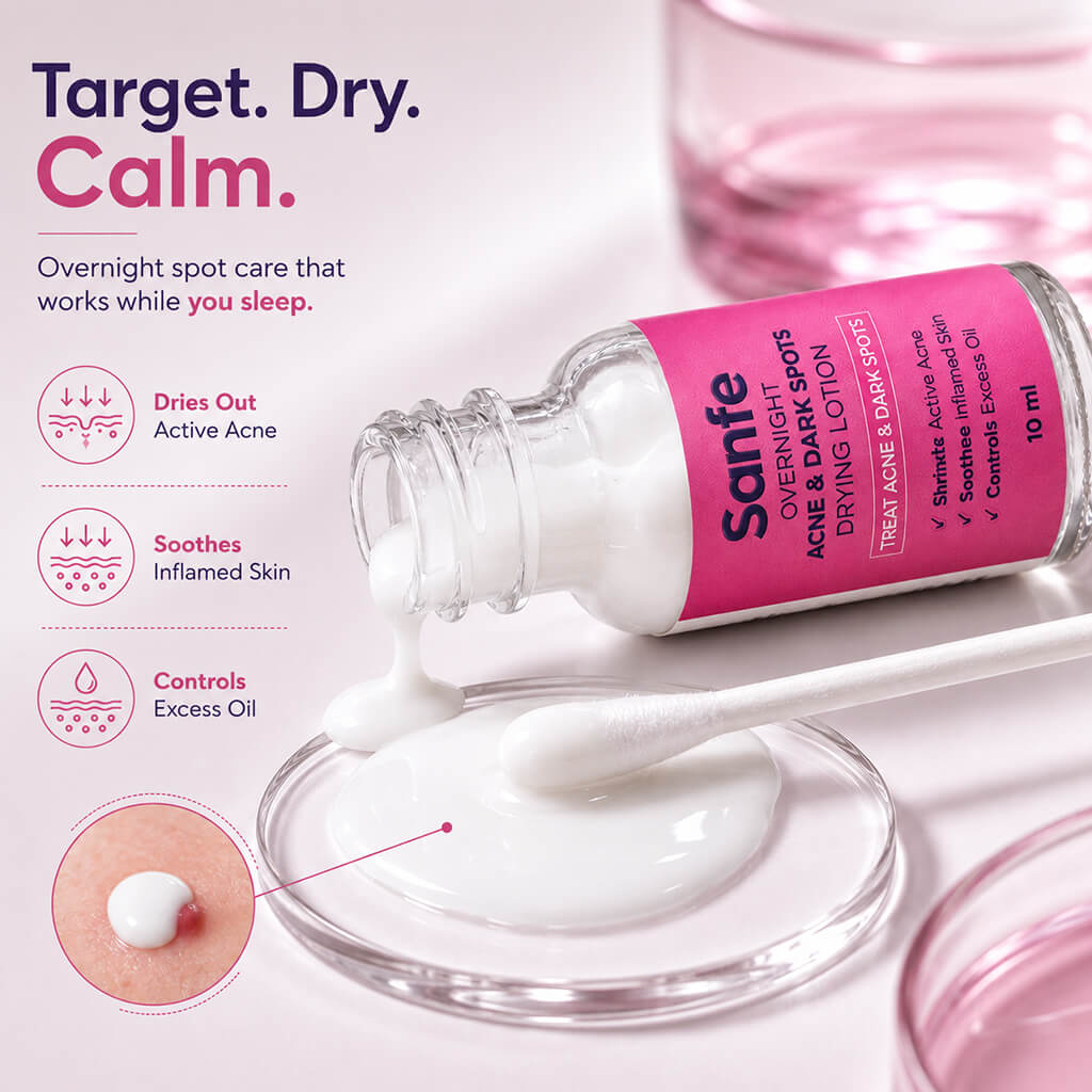 Sanfe Overnight Acne & Dark Spots Drying Lotion - 10ml