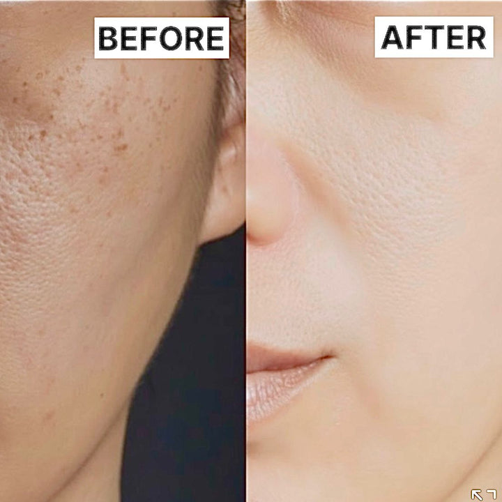 NanoLift Magnetic Face Mask