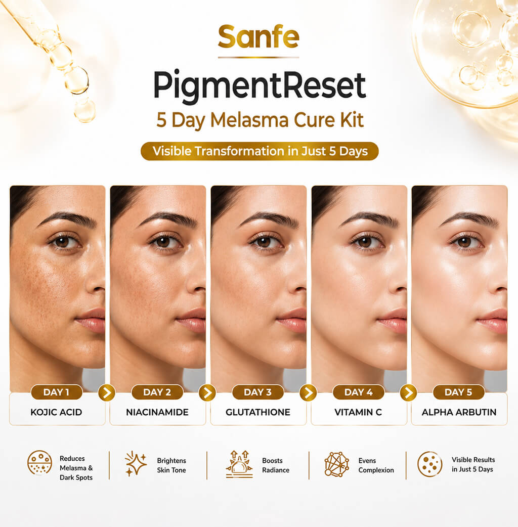 Sanfe PigmentReset 5 Day Melasma Cure Kit