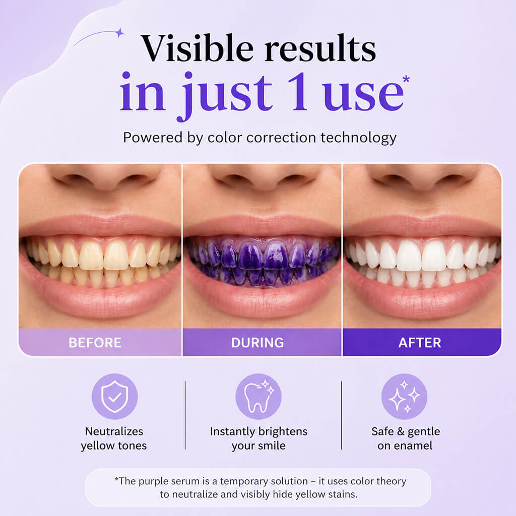 Purple Teeth Whitening Gel