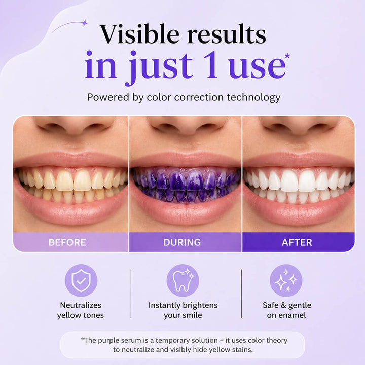Purple Teeth Whitening Gel