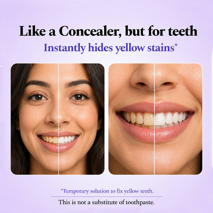 Purple Teeth Whitening Gel