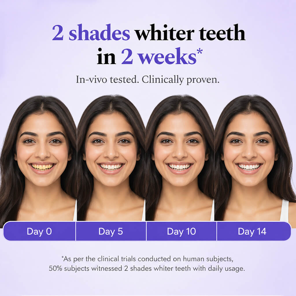 Purple Teeth Whitening Gel
