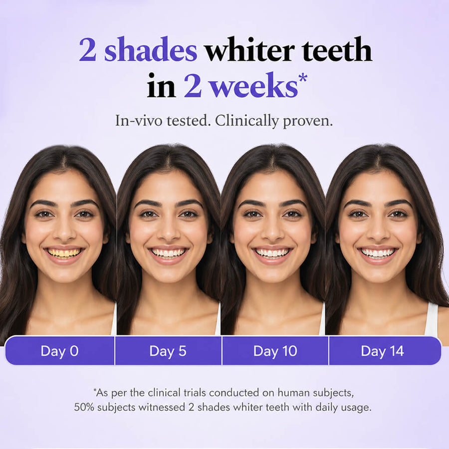 Sanfe Purple Teeth Whitening Gel | Instant Stain Removal & Bright Smile