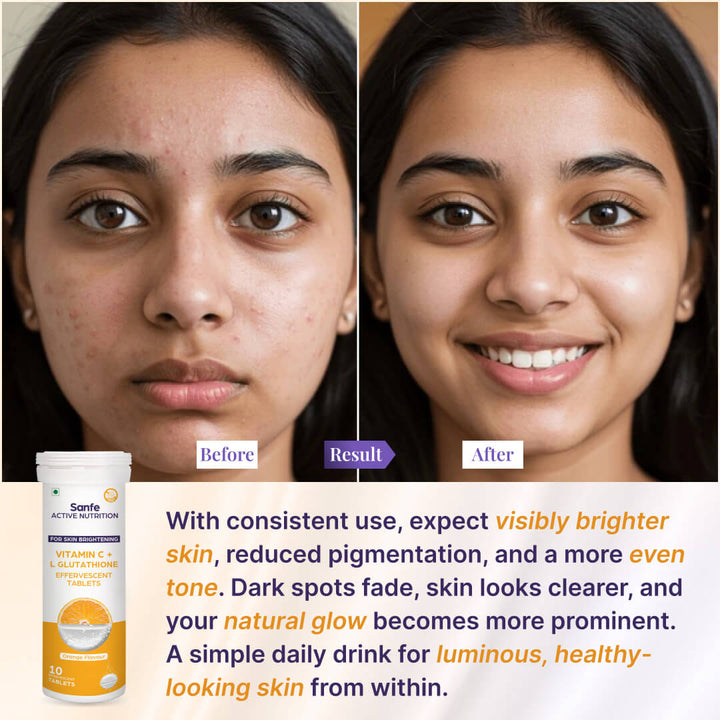 Sanfe Effervescent Tablets, Vitamin C + L Glutathione (Orange) | For Skin Brightening, 40 Tablets