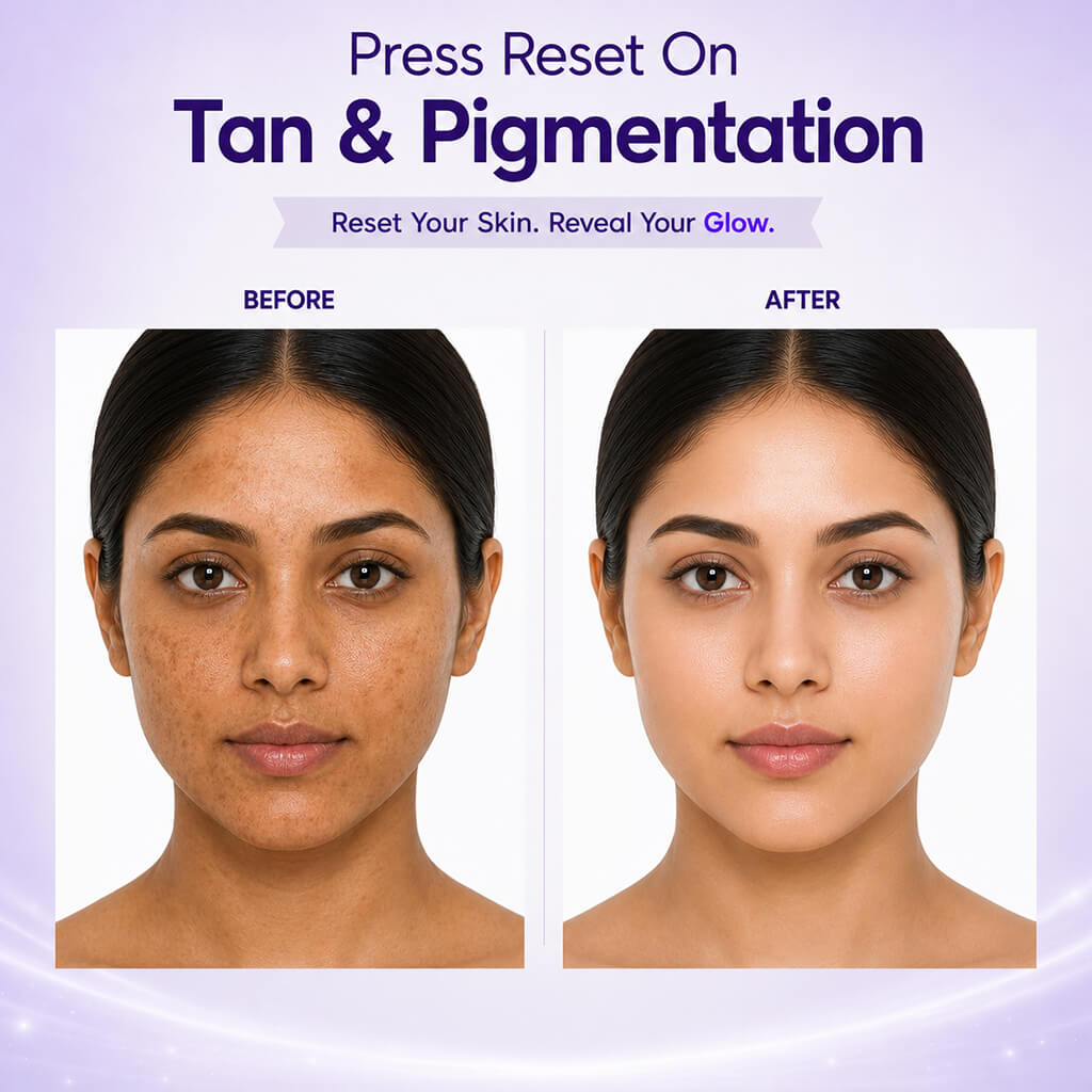 Sanfe Skin Brightening Combo | Exfoliating Tan Removal Gel & Kojic Acid Soap for Pigmentation Care