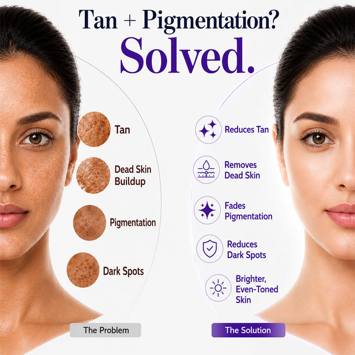 Sanfe Skin Brightening Combo | Exfoliating Tan Removal Gel & Kojic Acid Soap for Pigmentation Care