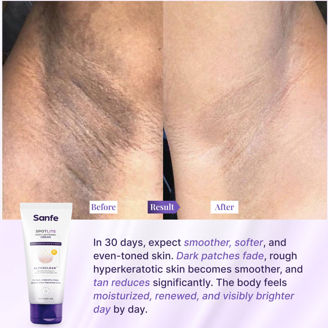 Spotlite Body Lightening Cream