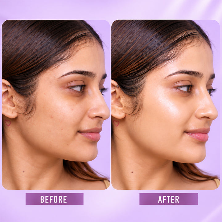 Sanfe GlowAura Strobe Cream (Gold) 30gm
