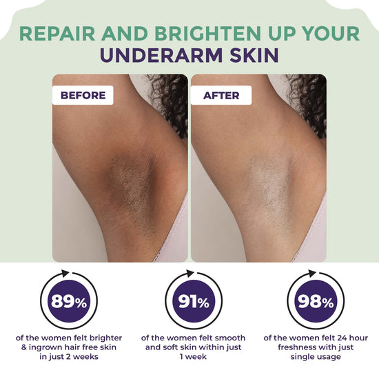 Sanfe Underarm Lightening Roll On | Lightens & removes pigmentation Treats ingrowns | 24-hour freshness | Deodorant for Underarms | 50ml
