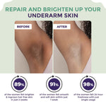 Sanfe Underarm Lightening Roll On For Women | Lightens & removes pigmentation | Treats ingrowns | 24-hour freshness | Deodorant for Underarms | 50ml