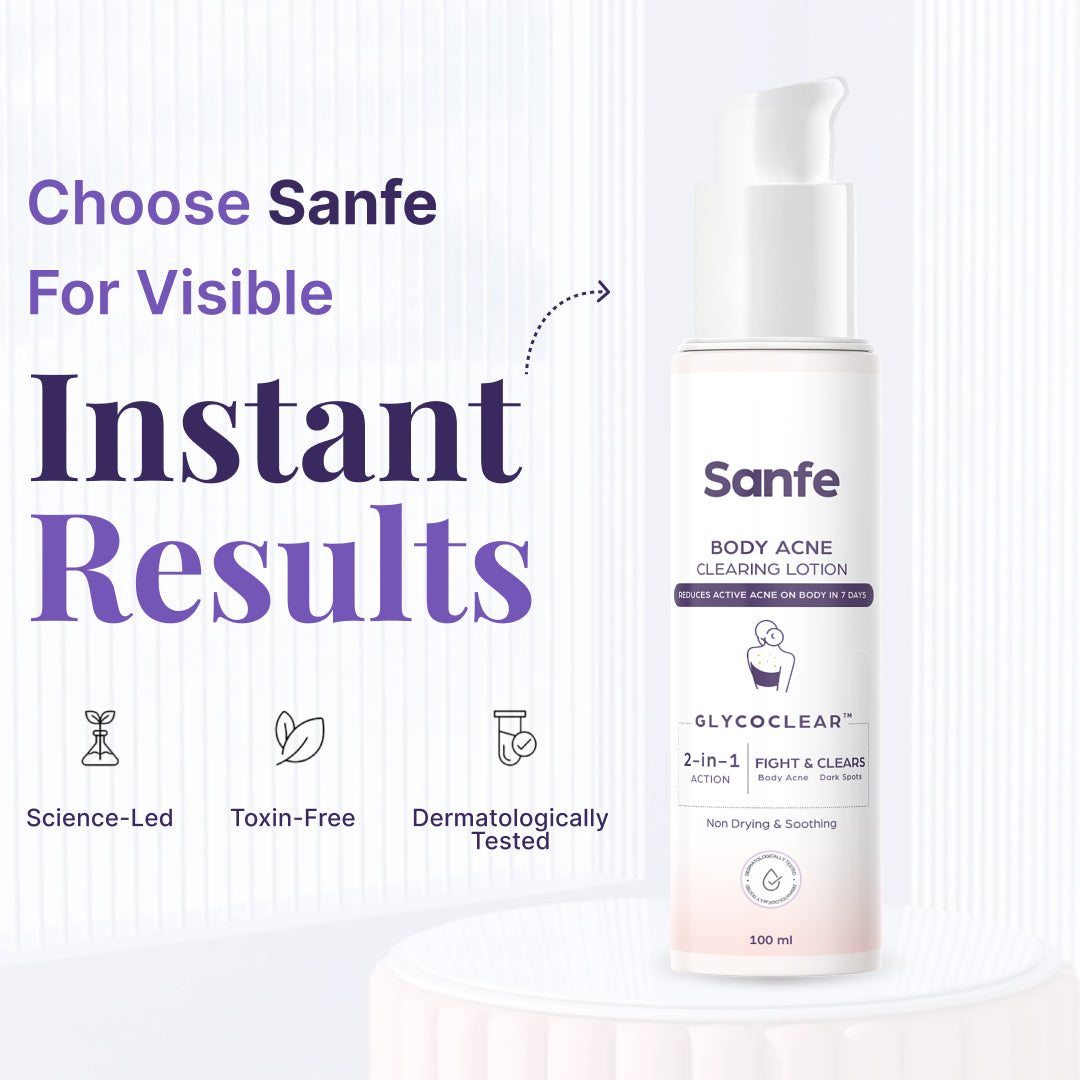 Sanfe Body Acne Clearing Lotion 100ml