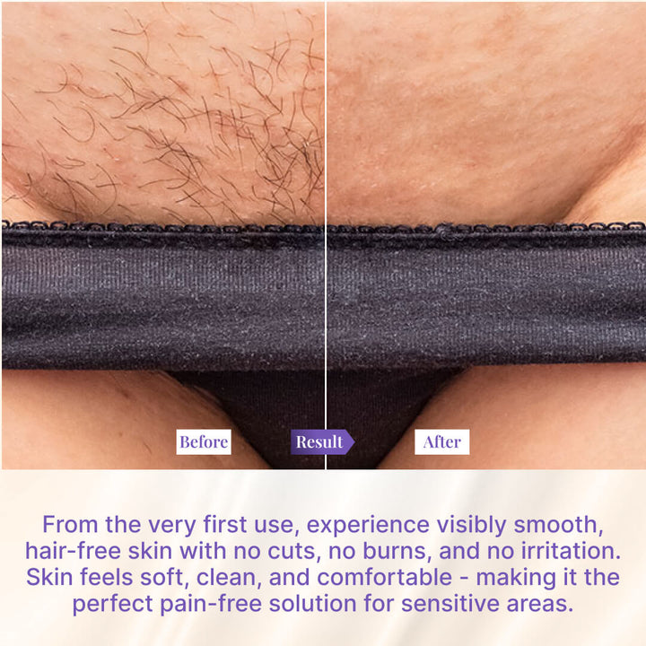 Bikini Line Hair Removal Cream For Pain Free Hair Removal - 50ml