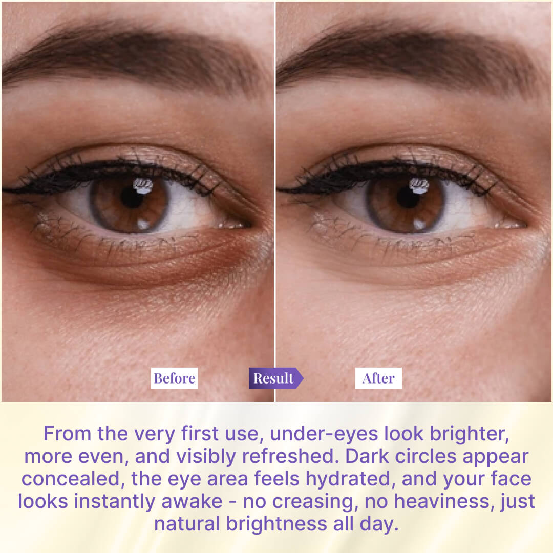 Sanfe Brighten & Conceal Undereye Cream | For dark Circles, wrinkles & Puffiness - 20g