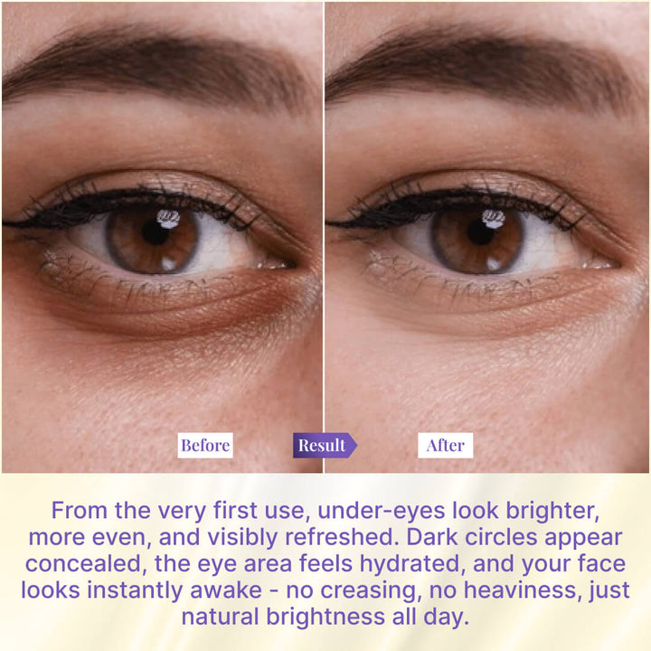 Sanfe Brighten & Conceal Undereye Cream | For dark Circles, wrinkles & Puffiness - 20g