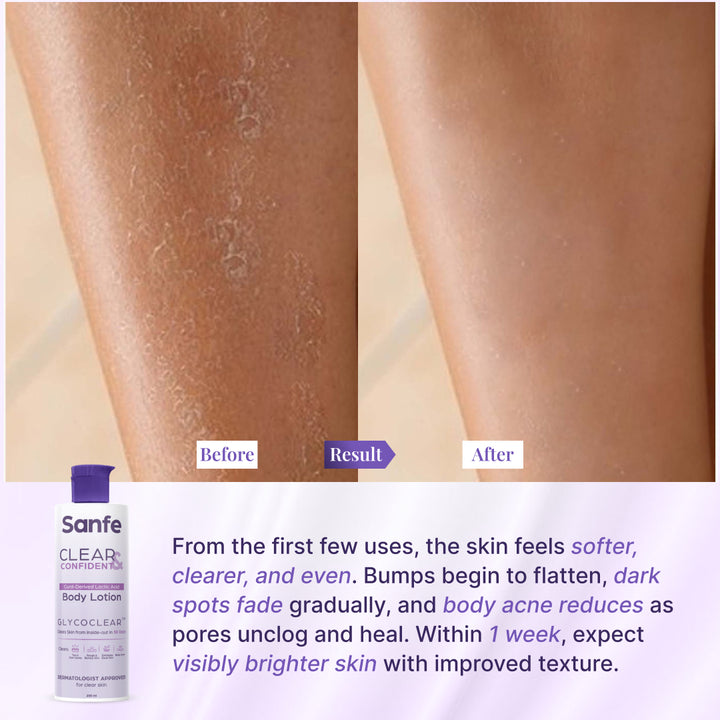 Glycolic Acid Body Lotion