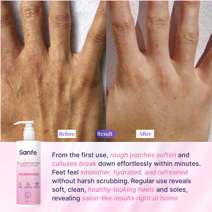 Sanfe Collagen Retinol Body Lotion - 200ml