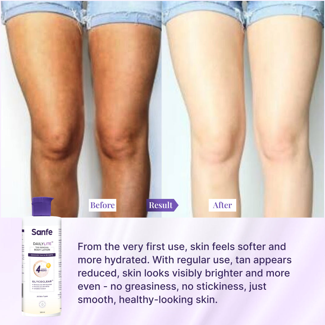 DailyLite Tan Removal Body Lotion