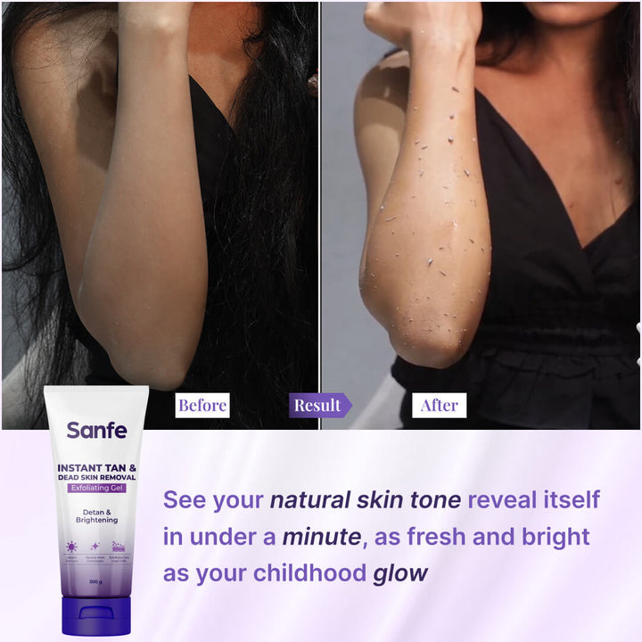 Sanfe Instant Tan & Dead Skin Removal Exfoliating Gel 200g