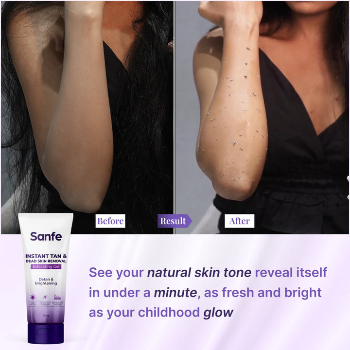 Sanfe Instant Tan & Dead Skin Removal Exfoliating Gel