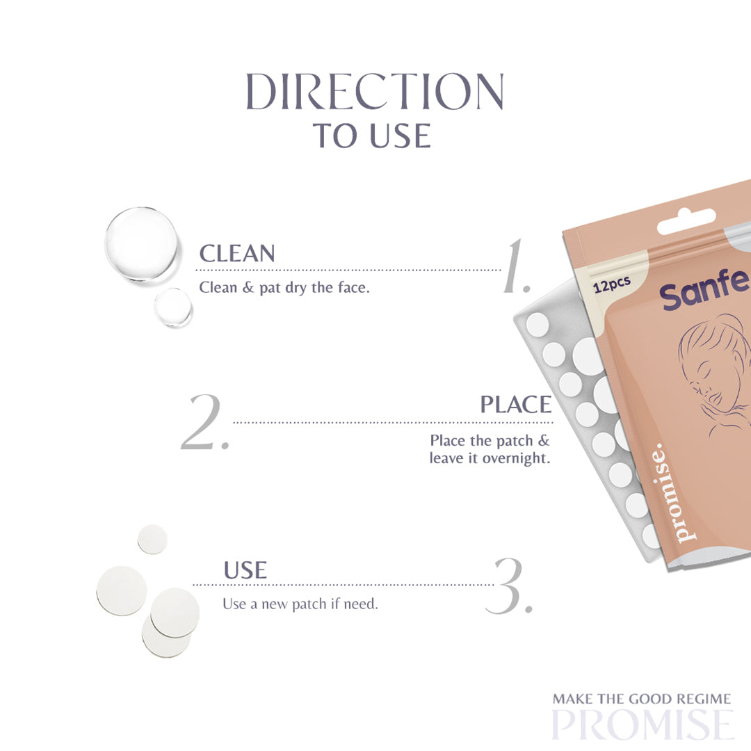 Sanfe Face Acne Clearing Glo Patch Pack of 72