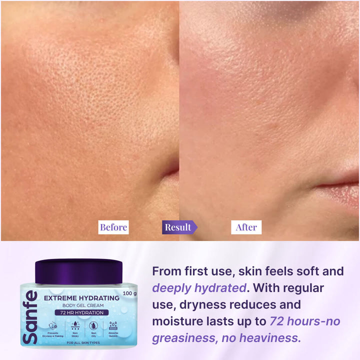 Sanfe Hydroboost Gel Cream