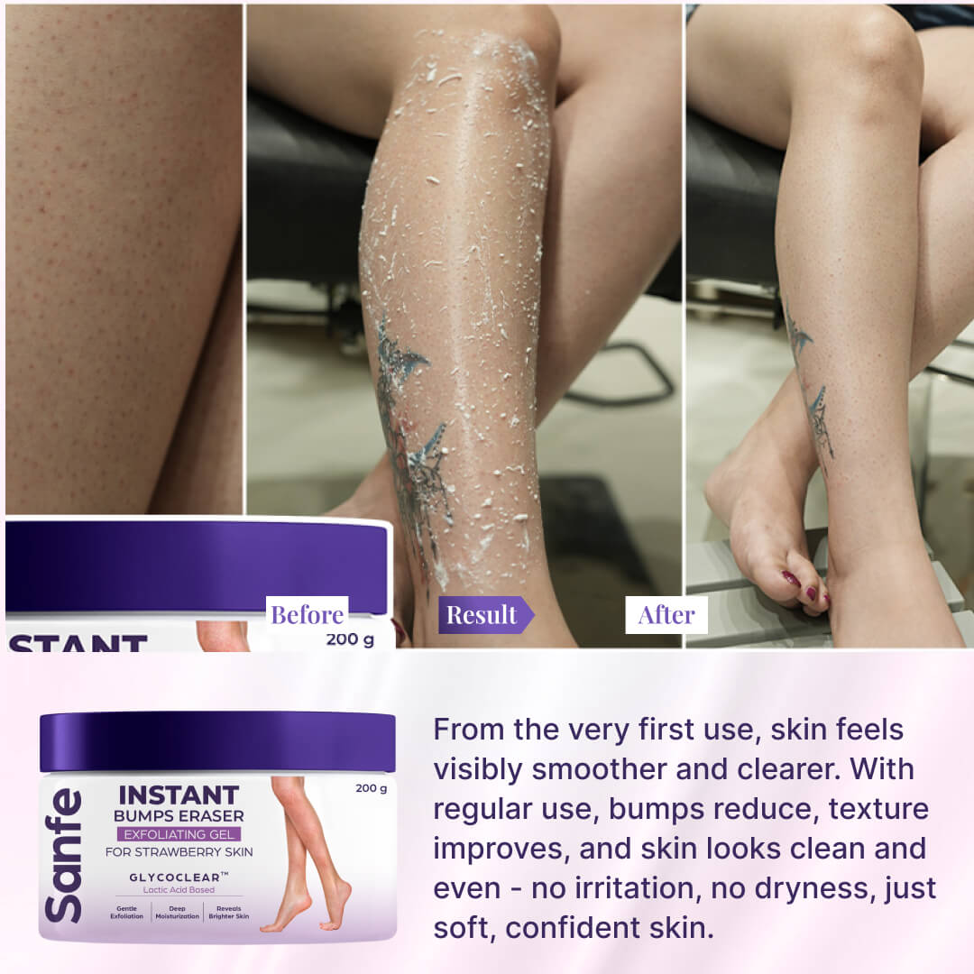 Sanfe Instant Bumps Eraser Exfoliating Gel