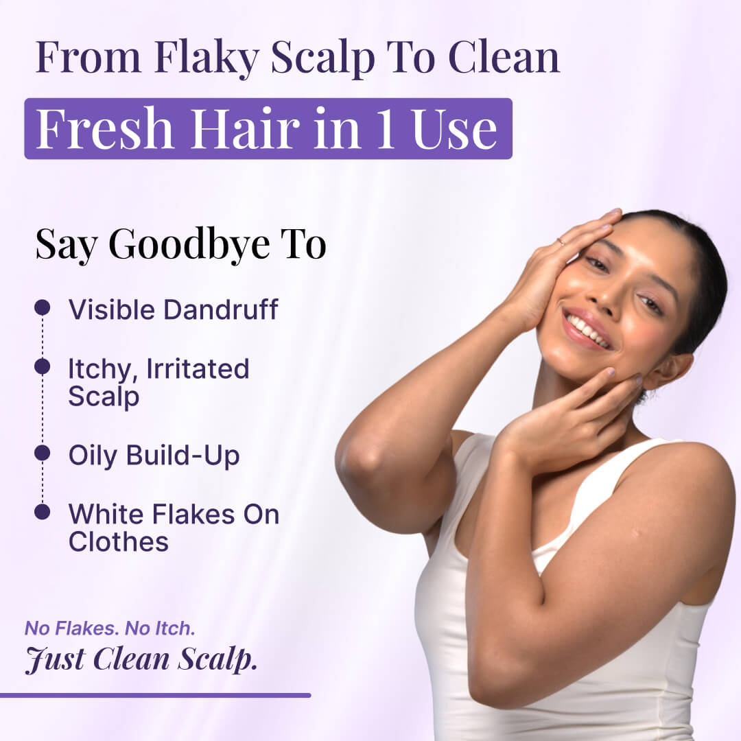 Instant Dandruff Removal Gel