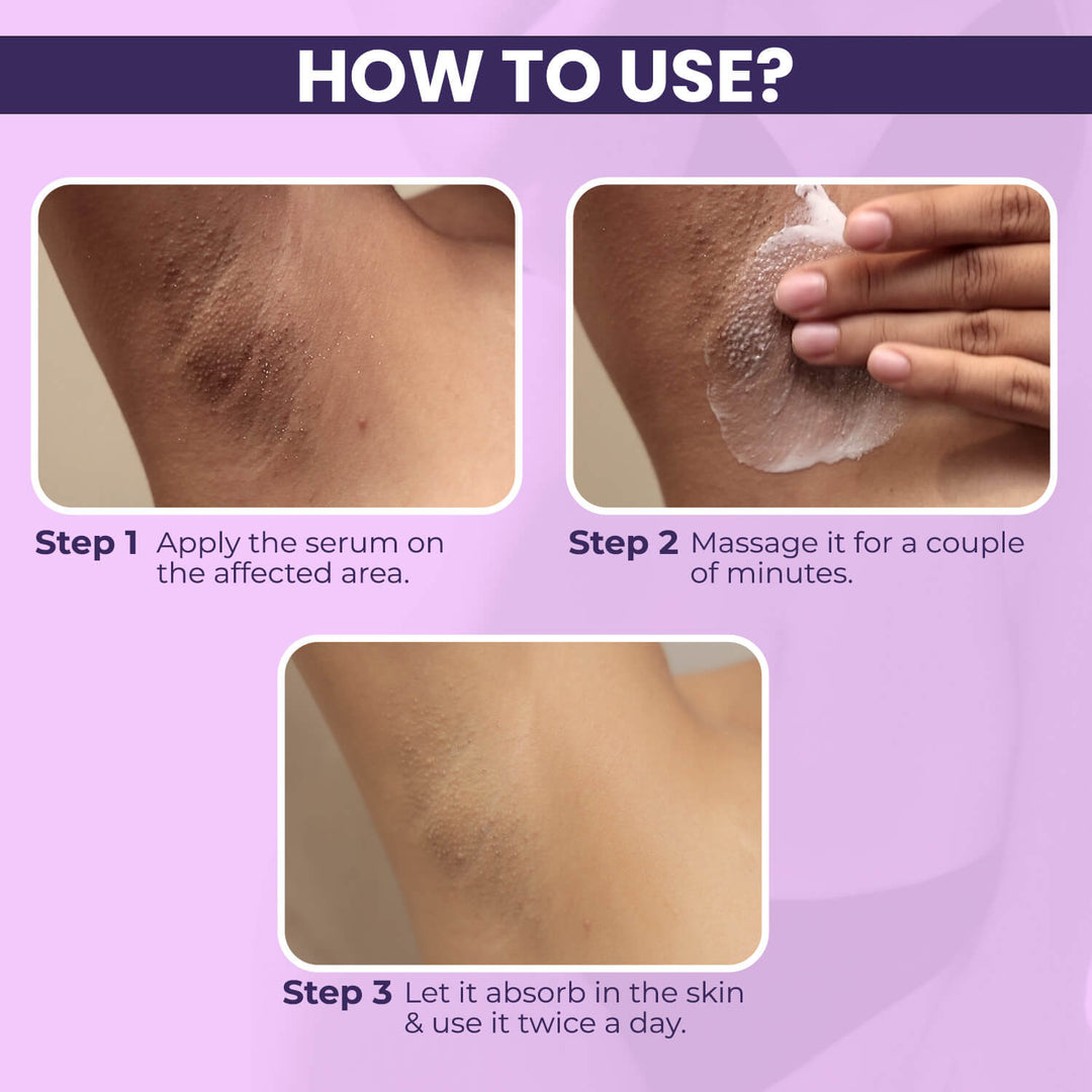 Intimate Lightening Serum 50gm