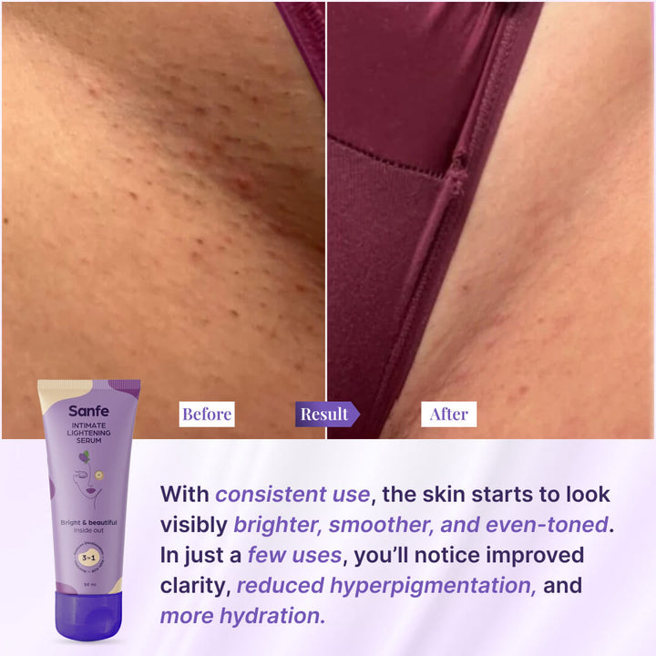 Intimate Lightening Serum 50gm