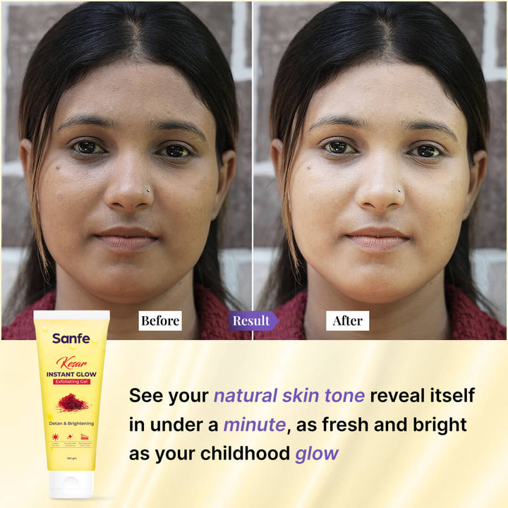 Sanfe Kesar Instant Glow Exfoliating Gel - 100g (Pack of 3)