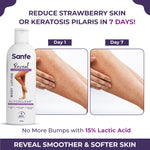 Sanfe Reveal No more bump body lotion - 200ml