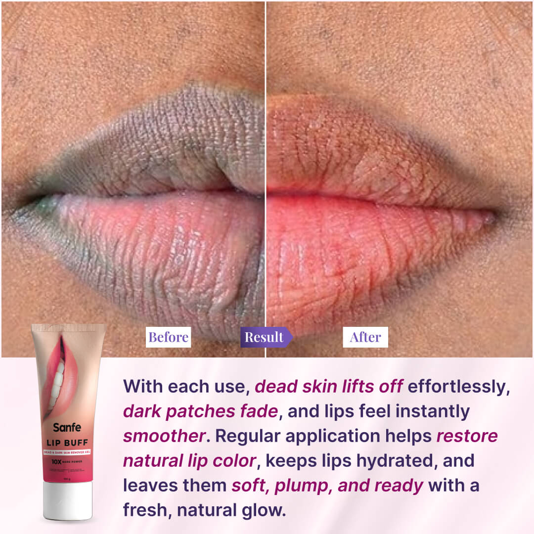 Sanfe lip buff dead & dark skin removal gel 100g