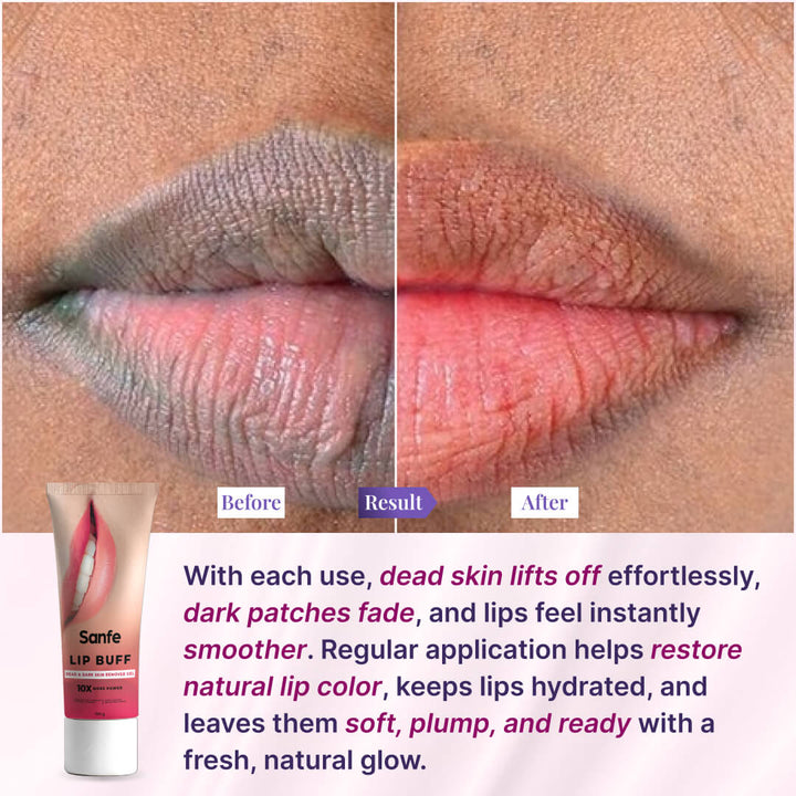 Sanfe lip buff dead & dark skin removal gel 100g
