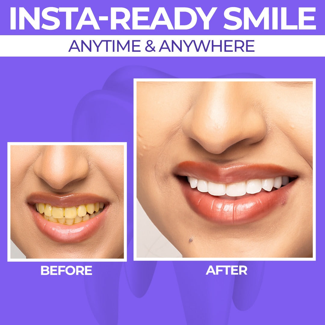 Purple Teeth Whitening Gel