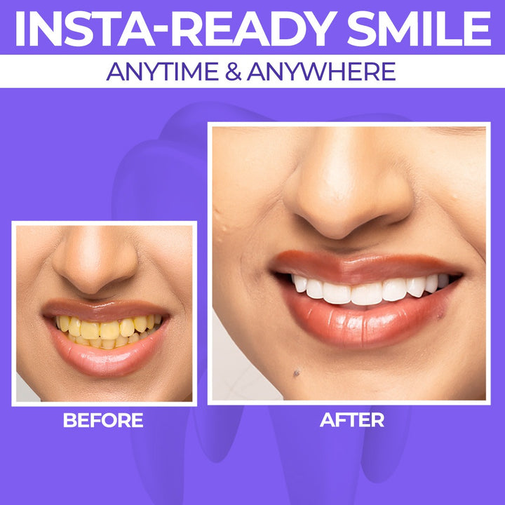 Purple Teeth Whitening Gel