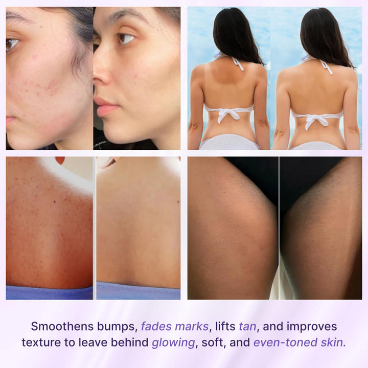 Radhika Blissful Beauty Bundle