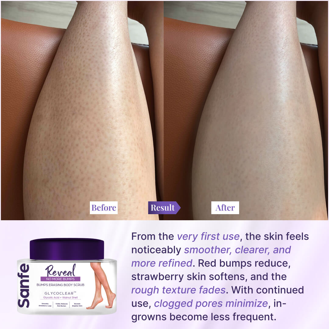 Bumps Erasing Body Scrub