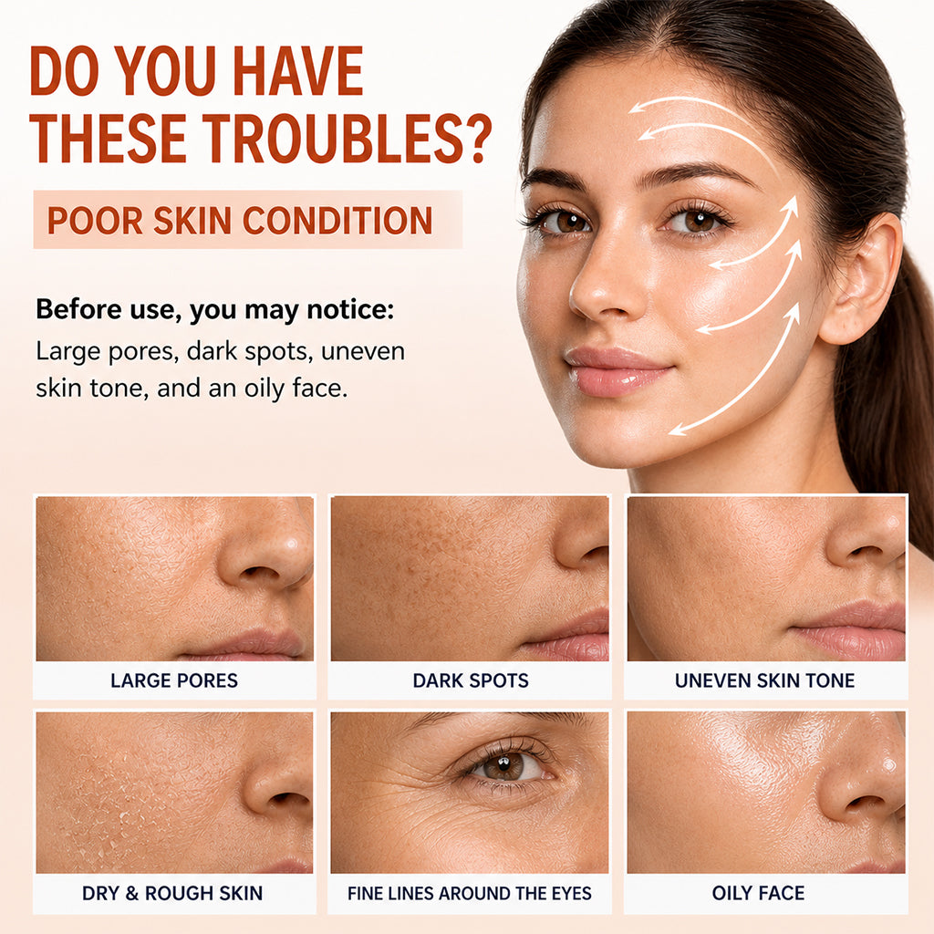 Sanfe FibraLift Instant Soluble Collagen Threads