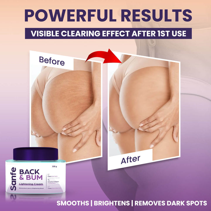 Back and Bum lightening Cream - 100gm