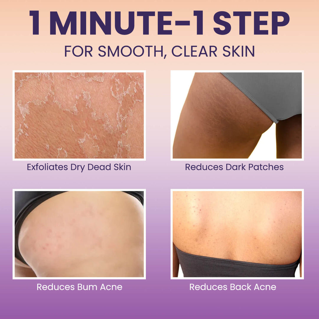 Back and Bum lightening Cream - 100gm
