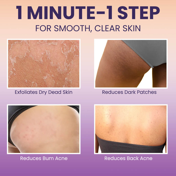 Back and Bum lightening Cream - 100gm