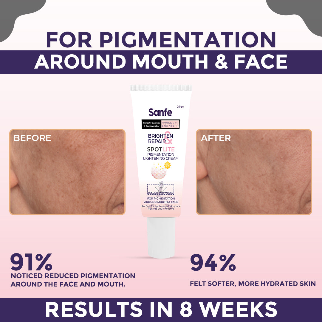 Brighten & repair Dark Spots Corrector Cream