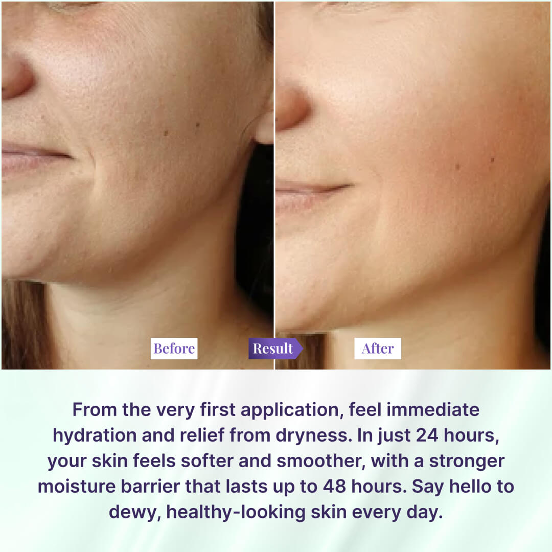 Sanfe Moisturizing Lotion - 100ml