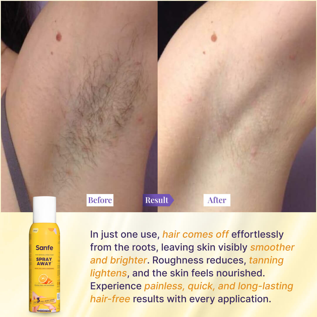 Spray Away Hair Removal Spray - 200ml (Pack of 2)