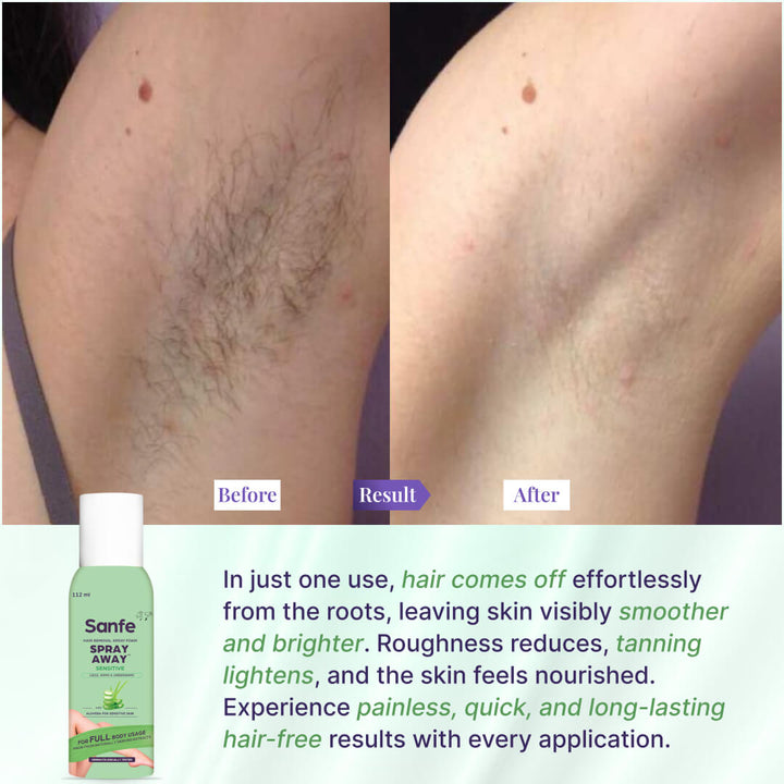 Hair Removal Spray for Bikini Area, Prevent Ingrown Hairs, Reduce Razor Bumps, Soothe Irritation - 112ml