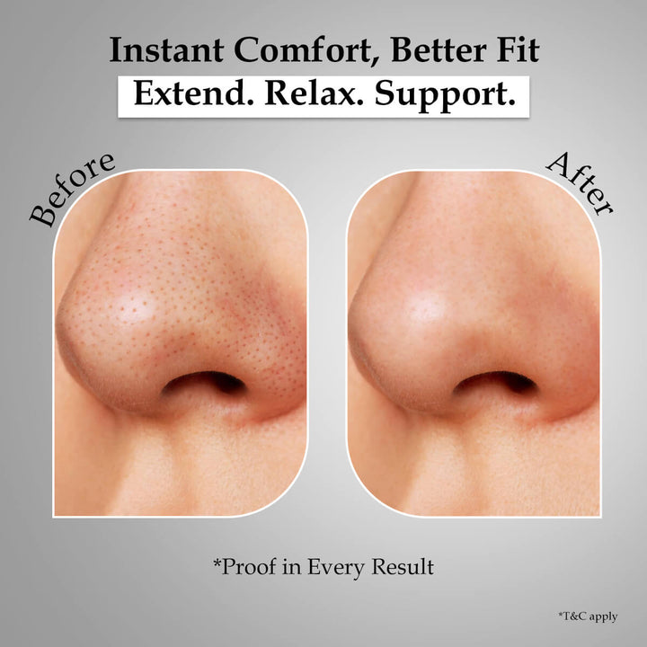 Sanfe SuckOut Blackhead Wrap