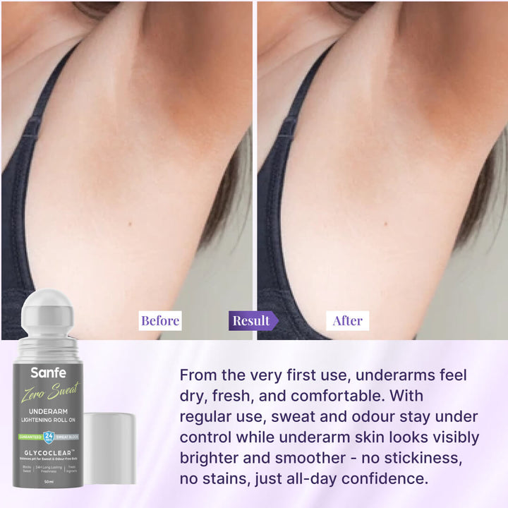 Sanfe Zero Sweat Underarm Lightening Roll On Lightens Men & Women, 50ml